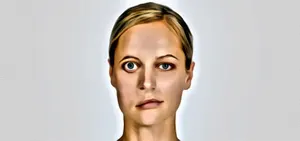 Yüz Felci